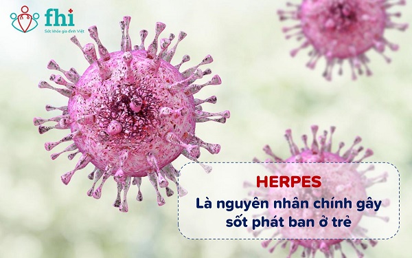 virus herpes sốt phát ban ở trẻ